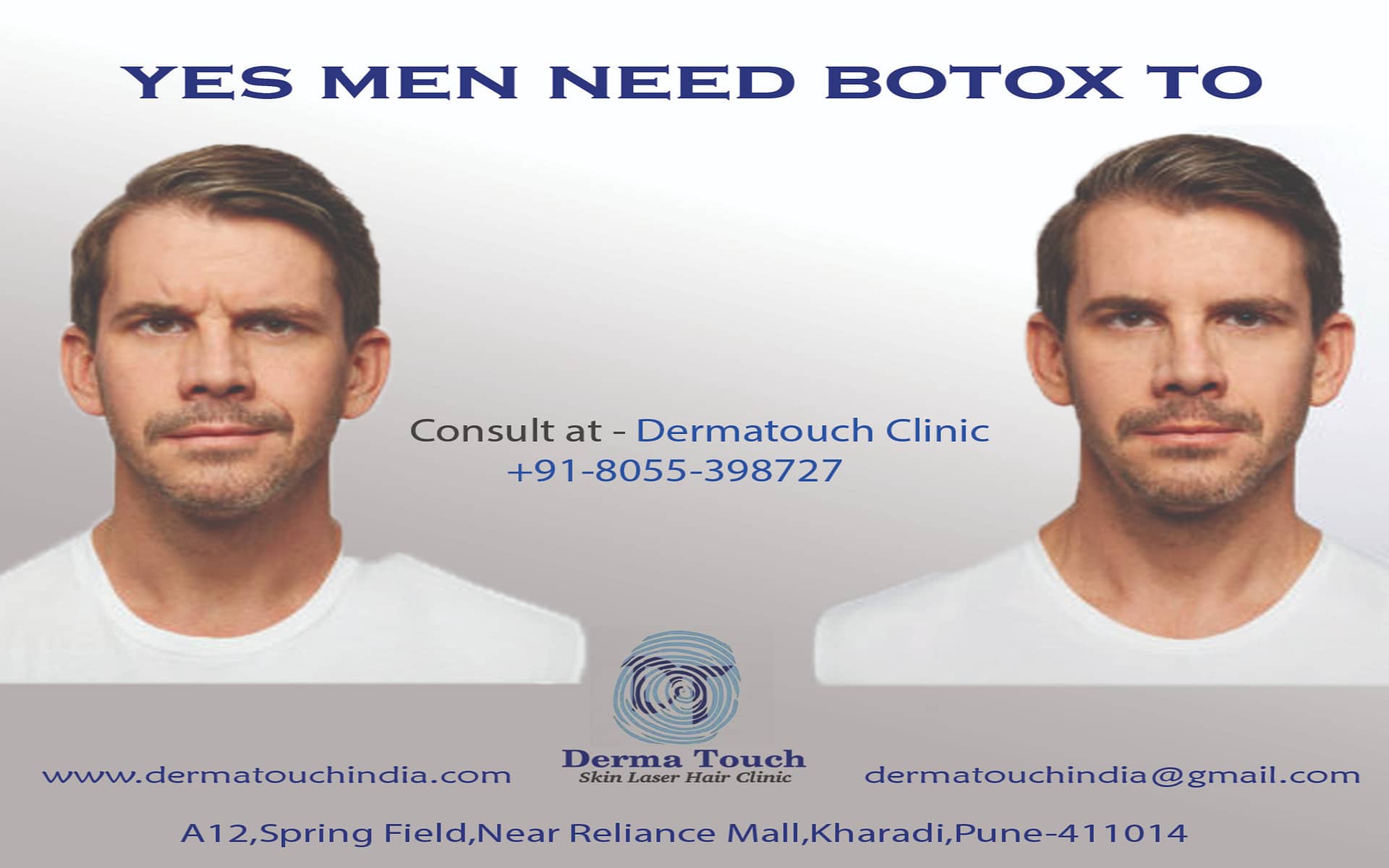 Botox men Derma Touch